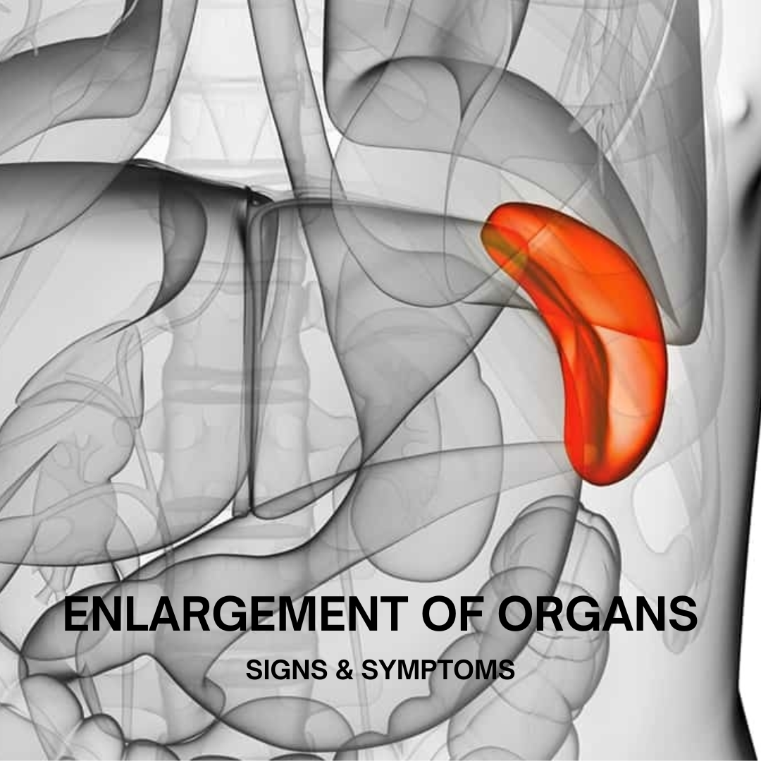 enlargment of organs
