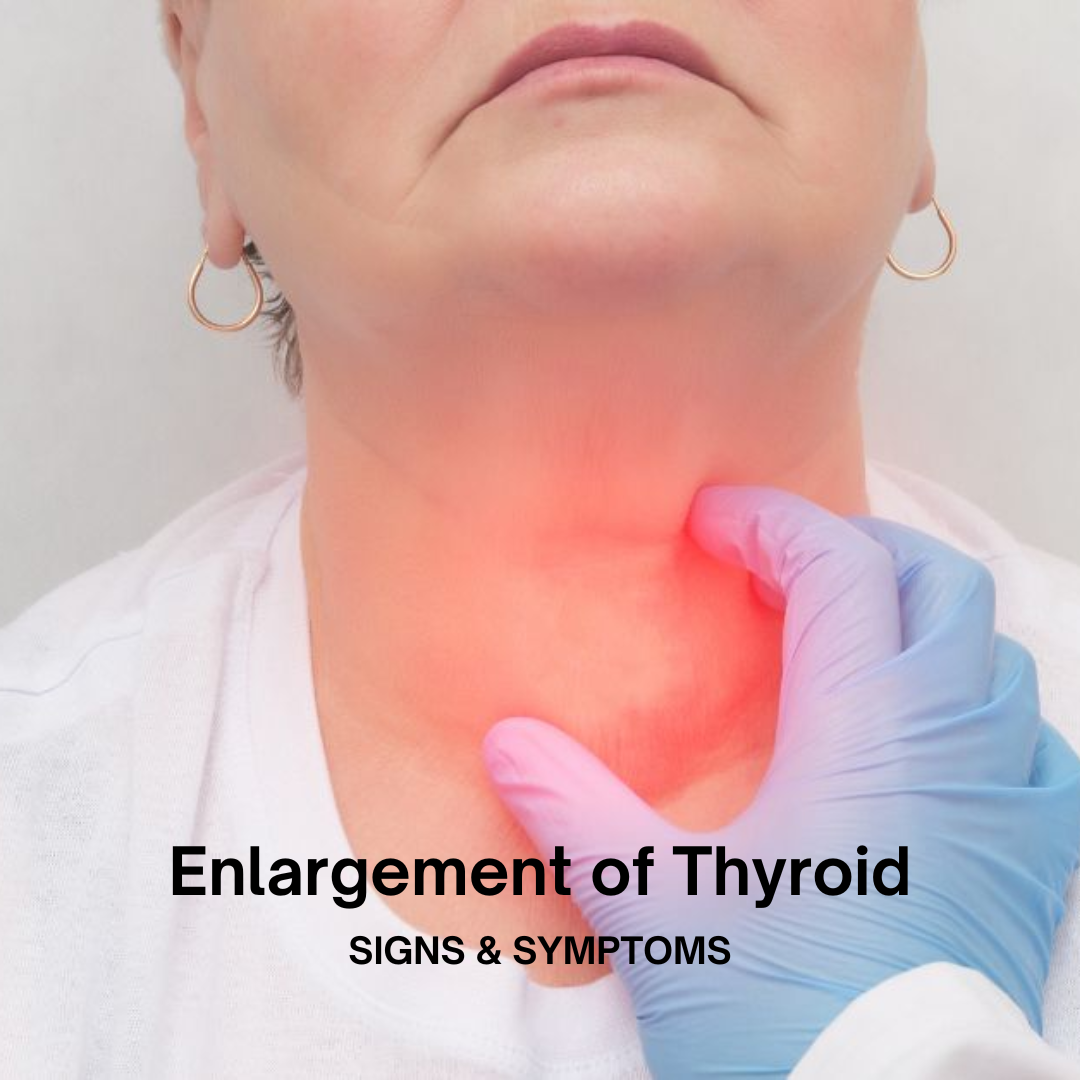 enlargment of thyroid