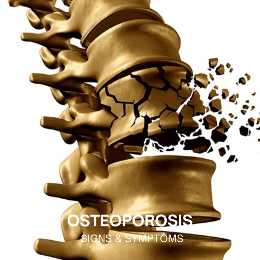 osteoporosis