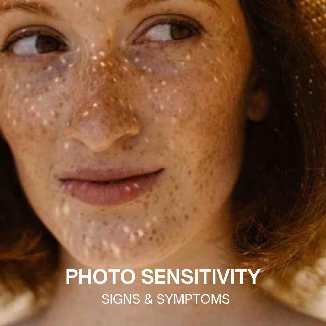 photo sensitivity