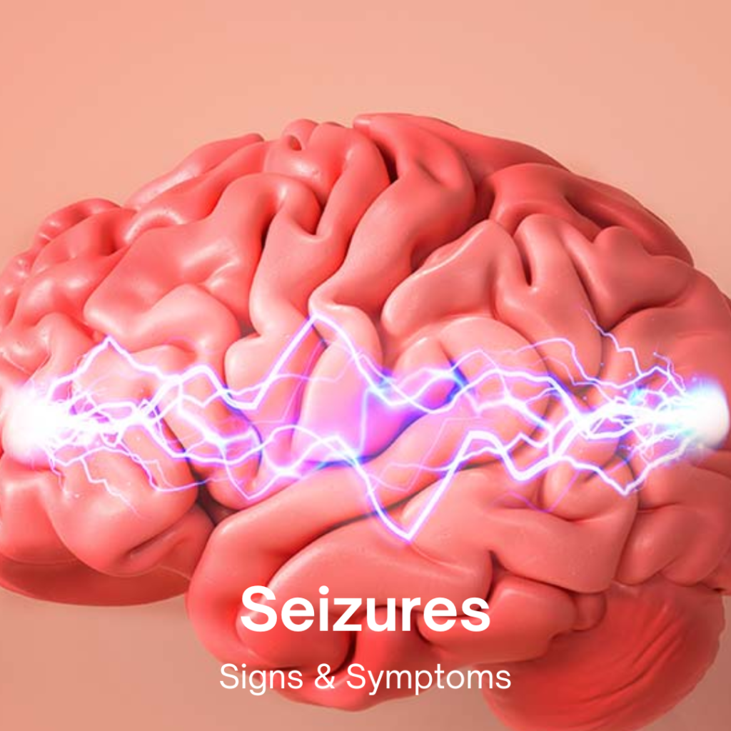 seizures